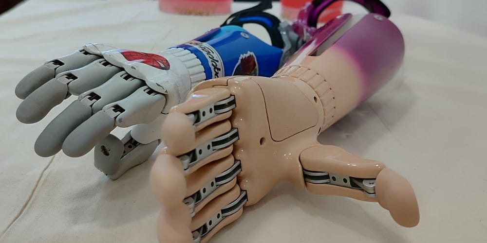 В 2025 году протезно-ортопедическую помощь получили 11.5 тысячи кыргызстанцев изображение публикации