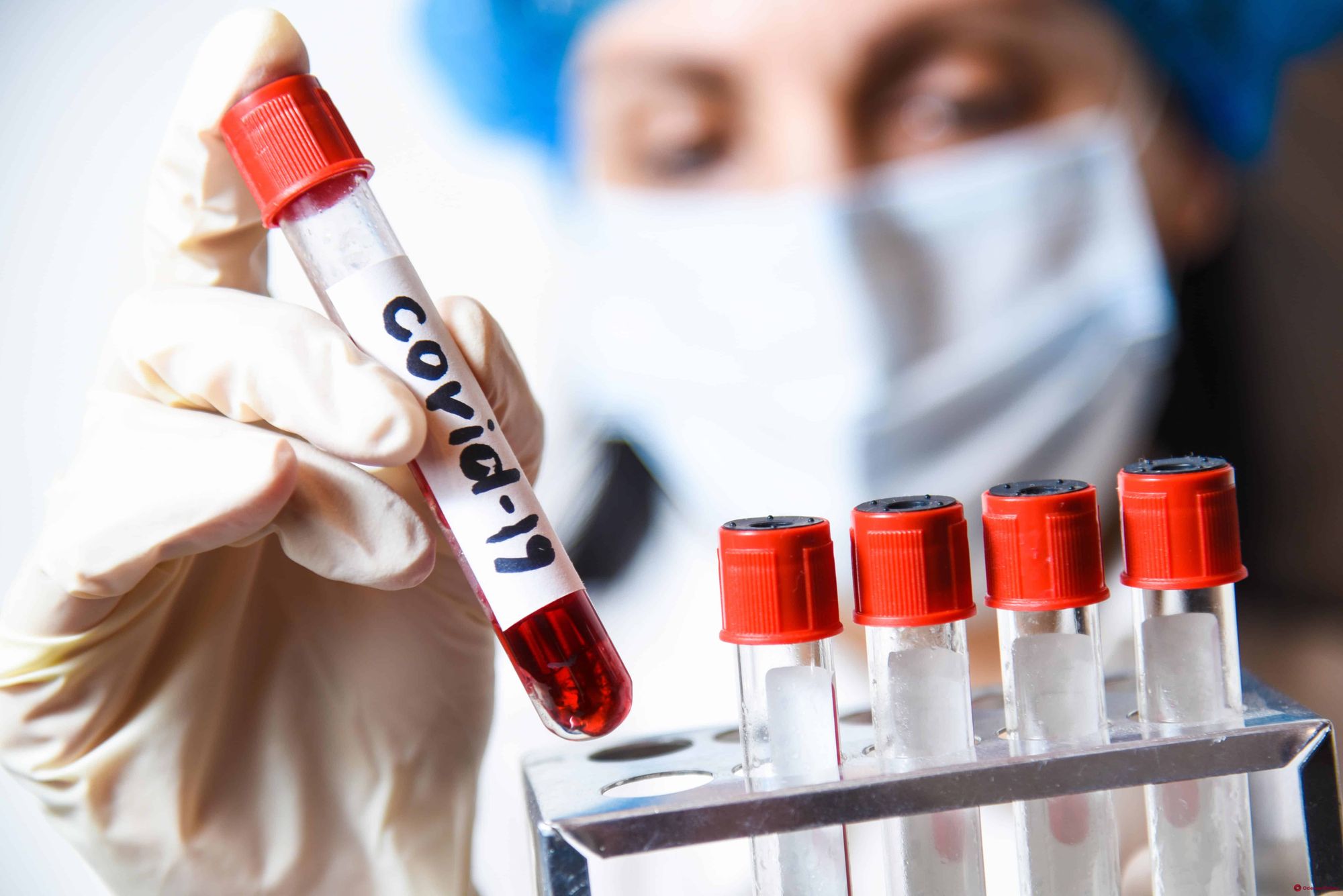 «Джеруй» планирует закупку в Канаде тест-систем для выявления коронавируса