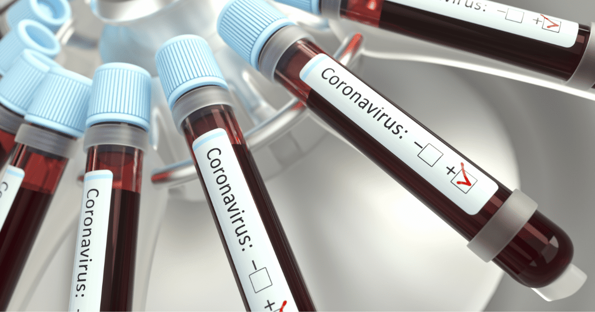 Япония безвозмездно передала Кыргызстану 2 тысячи тестов для выявления коронавируса