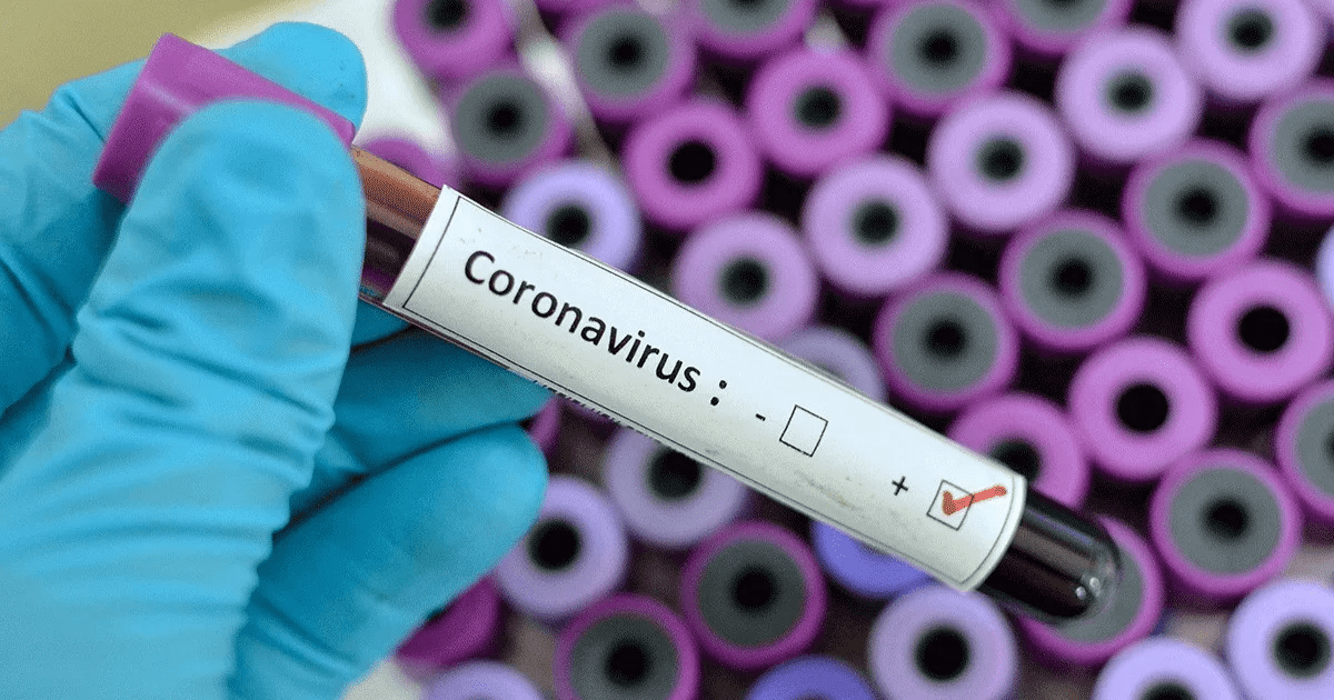 В Кыргызстане имеется порядка 10 тысяч тест-систем для выявления коронавируса