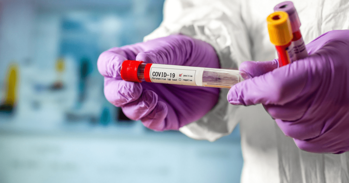 Госантимонополия попросила лаборатории не завышать цены на ПЦР-тесты и лучевую диагностику