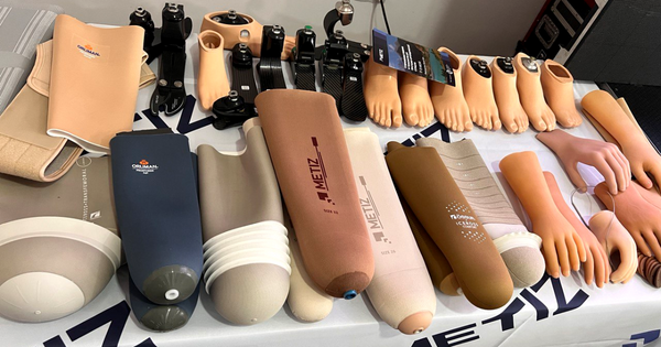 Государство выделило 1.7 млн сомов для обеспечения детей бесплатными протезами рук изображение публикации