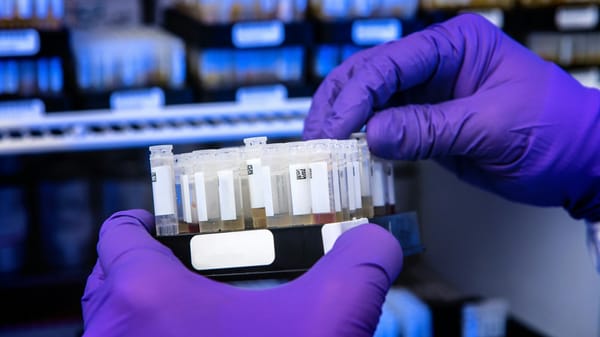 Республиканский центр крови закупит тест-системы и расходники на 17.7 млн изображение публикации