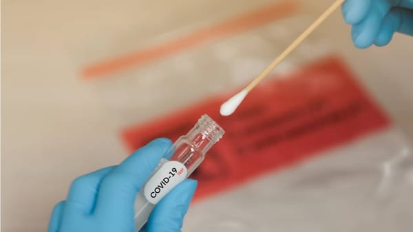 Кыргызстан потратит 9 млн сомов на покупку экспресс-тестов в Китае изображение публикации