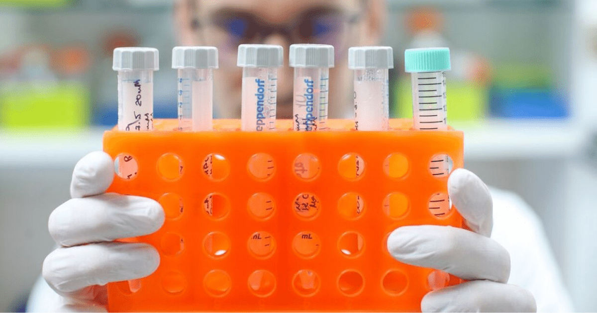 Из Беларуси доставят 25 тысяч тестов на проверку коронавируса изображение публикации