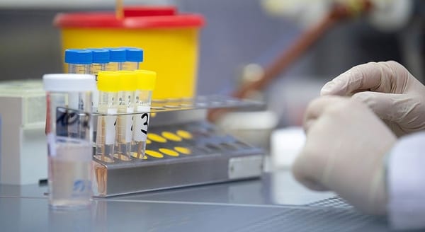 Роспотребнадзор протестирует кыргызские лаборатории — это облегчит въезд в РФ изображение публикации