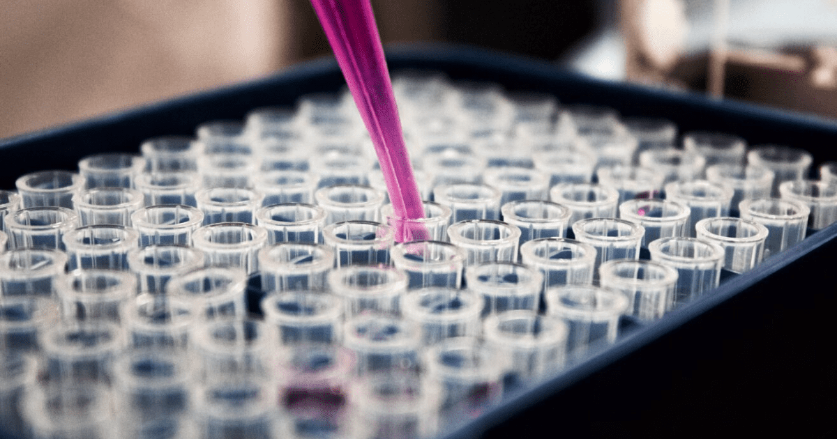 Частная лаборатория будет отправлять биоматериалы в Москву для точности анализа на COVID-19